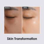 Medi-Peel Hyaluron Dark Benone Peptide 9 Ampoule Eye Patch (5)
