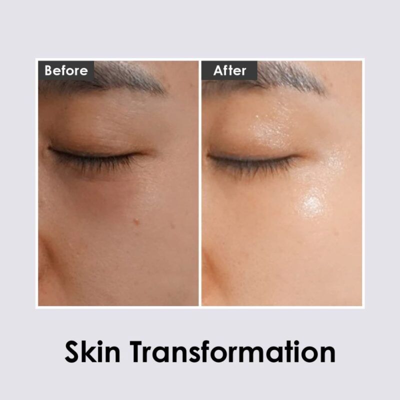 Medi-Peel Hyaluron Dark Benone Peptide 9 Ampoule Eye Patch (5)
