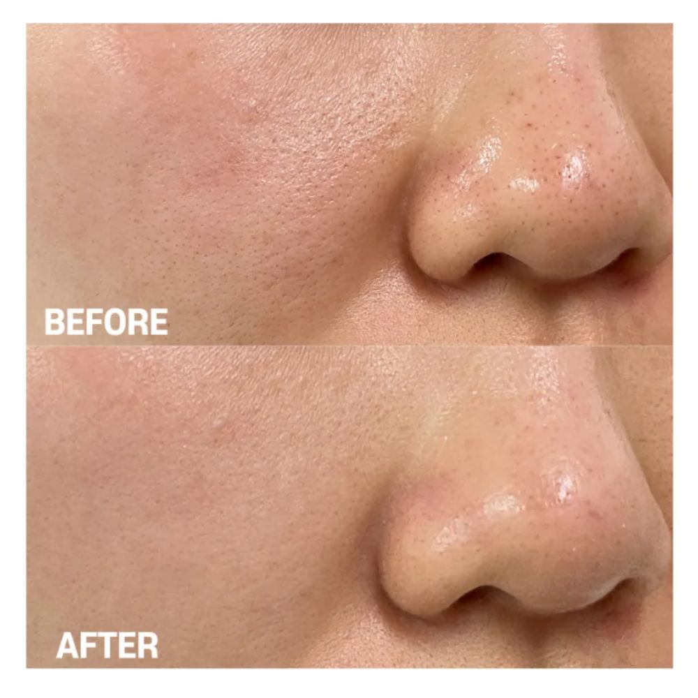 TIA’M Pore Minimizing 21 Serum (1)