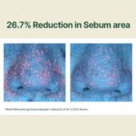 Pyunkang yul Calming Moisture Serum (1)