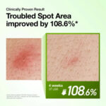 Anua Azelaic Acid 10 Hyaluron Redness Soothing Serum (3)