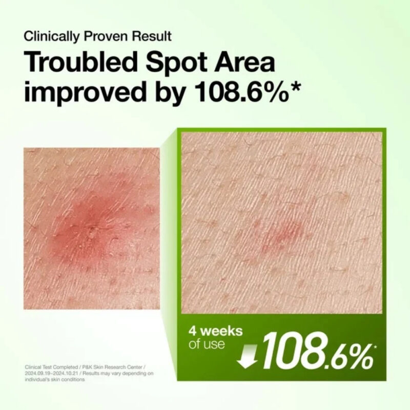Anua Azelaic Acid 10 Hyaluron Redness Soothing Serum (3)