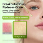 Anua Azelaic Acid 10 Hyaluron Redness Soothing Serum (4)