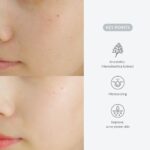Dr. Althea Last Minute Skin Rescue Anastatica Mask