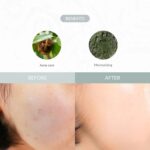 Dr. Althea Last Minute Skin Rescue Anastatica Mask