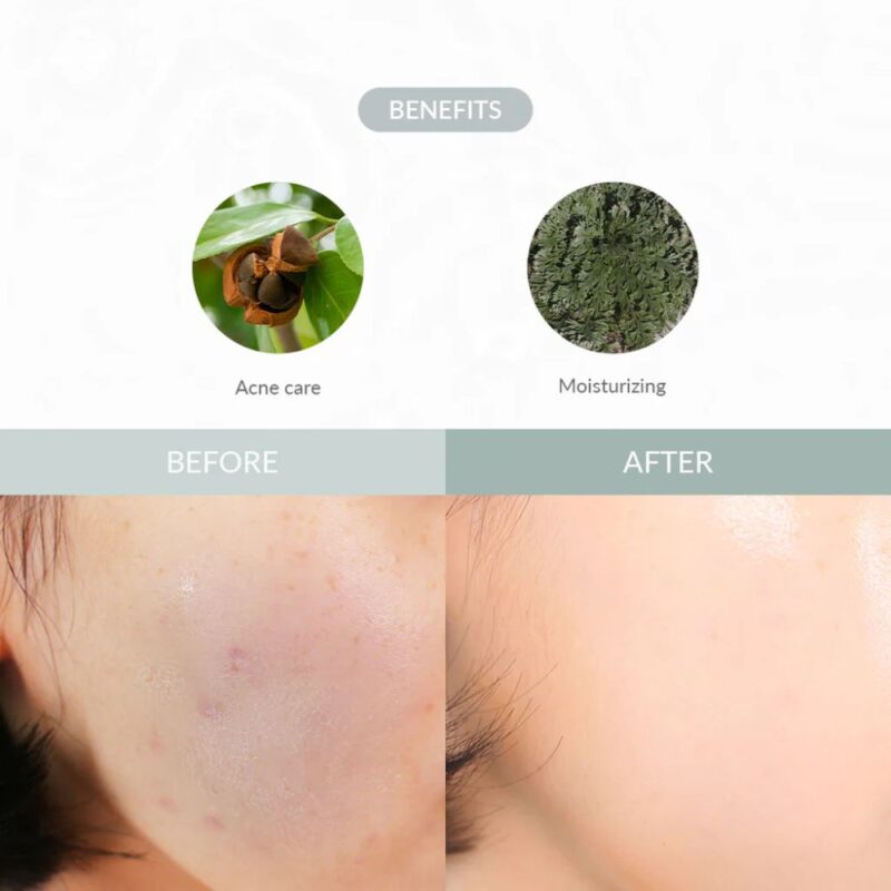 Dr. Althea Last Minute Skin Rescue Anastatica Mask
