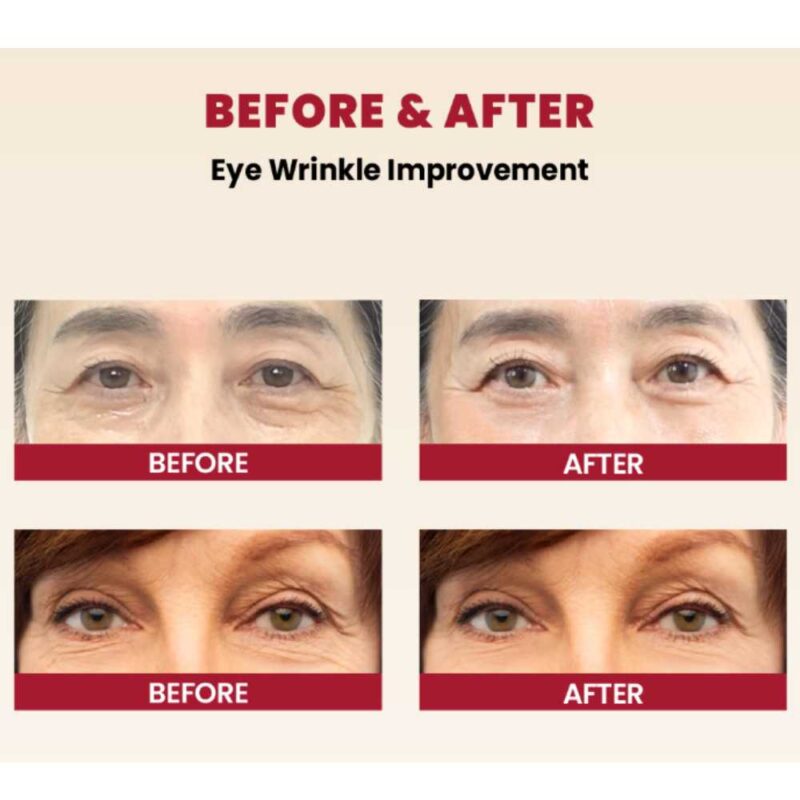 KSECRET Seoul 1988 Eye Cream_ Retinal Liposome 4% + Fermented Bean, 30ml - 5