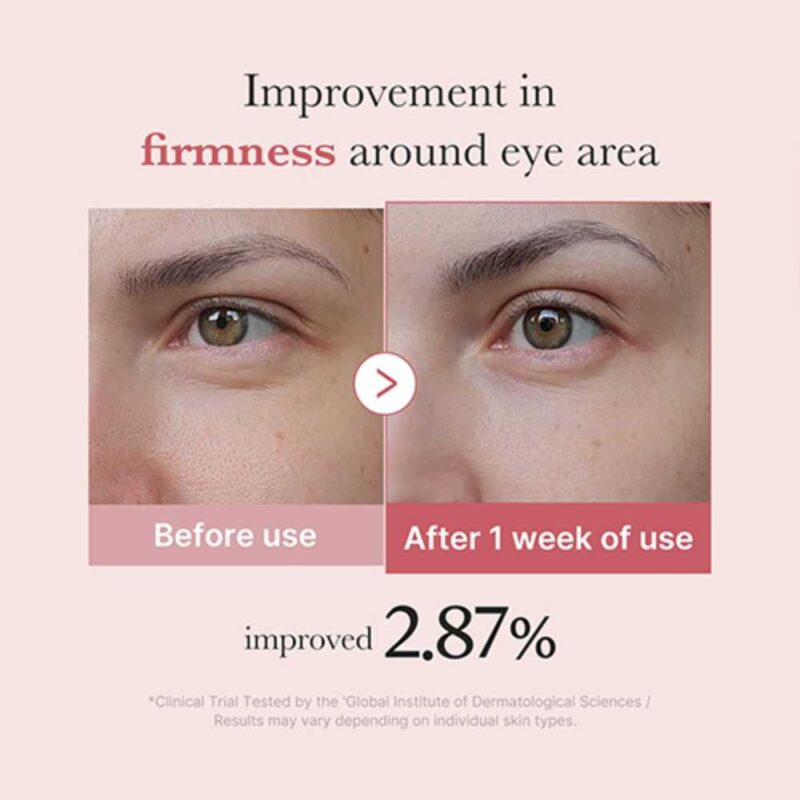 Medicube PDRN Pink Peptide Eye Cream, 30ml - 5