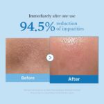 Medicube Zero Pore Blackhead Deep Cleansing Oil, 205ml - 5