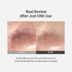 Sungboon Editorde Blackhead Melting Clear Pad (1)