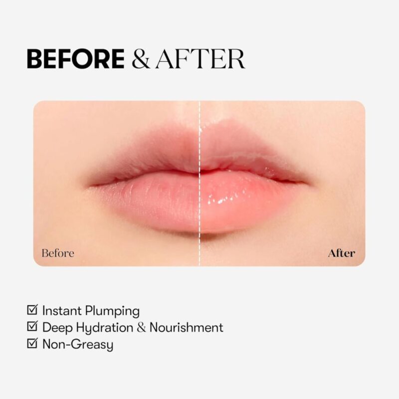 VT Cosmetics Reedle Shot Lip Plumper Beginner (3)