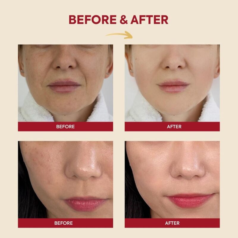 KSECRET SEOUL 1988 Essence Snail Mucin 97% + Rice (1)