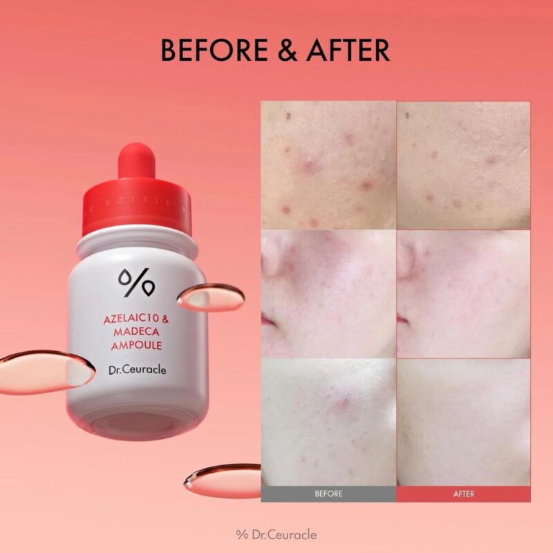Dr. Ceuracle Azelaic 10 and Madeca Ampoule (1)