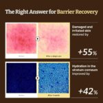 Dr. Reju-All Advanced LC-Ceramide Barrier Cream (5)