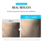 Eqqualberry Swimming Pool Toner (1)