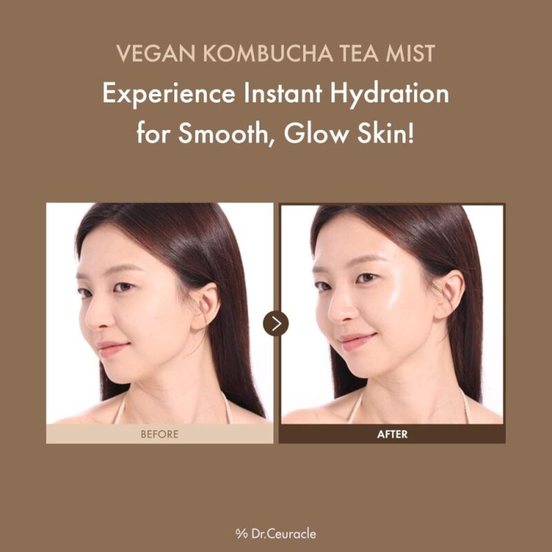 Dr. Ceuracle Vegan Kombucha Tea Mist (1)