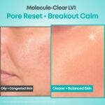 Nine Less Molecule-Clear Salicylic Acid Serum (2)