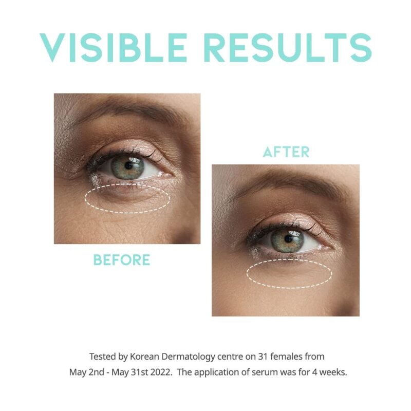 OOTD Wrinkle Lift Eye Serum (1)