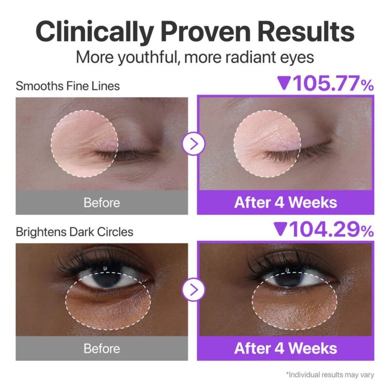 Numbuzin No.9 NAD Retinol Volumetox Eye Cream (1)