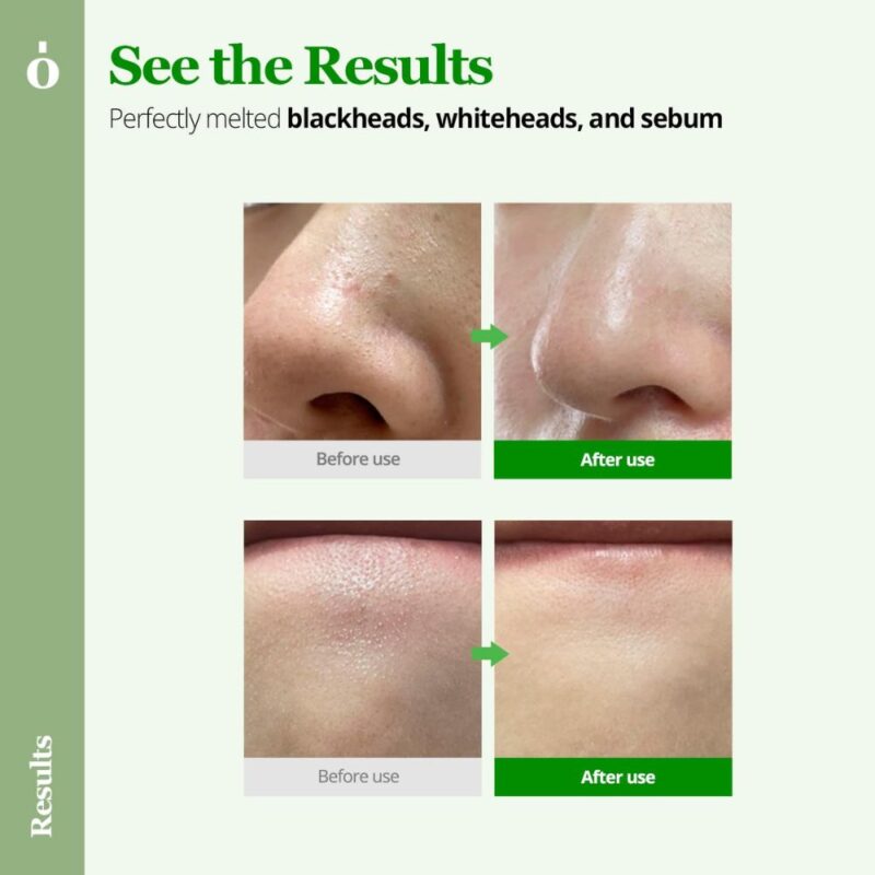 Ongredients Perfect Melting Cleansing Balm (1)