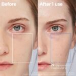 AESTURA Atobarrier 365 Lotion (2nd Generation) (5)