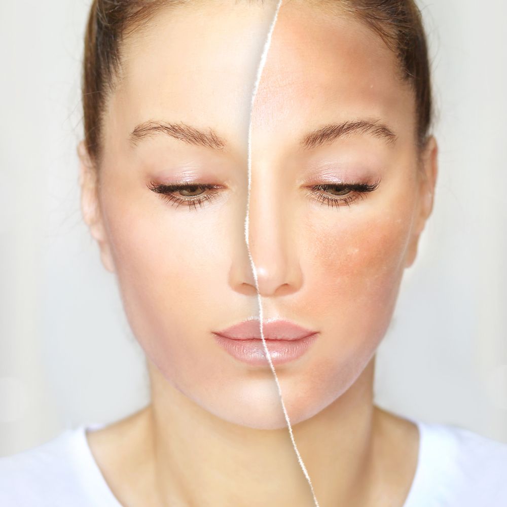 Bariera pielii compromisă cum o repari rapid și ce ingrediente să folosești