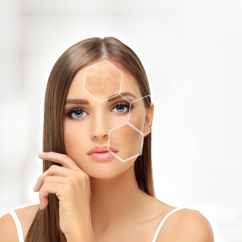 Petele pigmentare de ce apar și ce ingrediente le estompează eficient