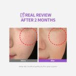 Sungboon Editor Meoru Podo VitaC Dark Spot Cream (1)