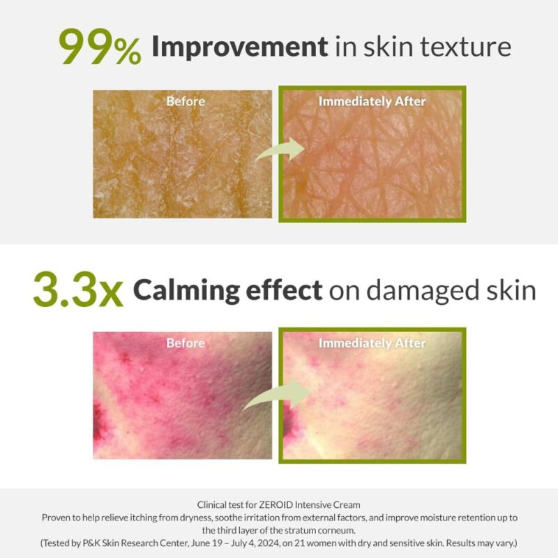 Zeroid Intensive Cream (1)