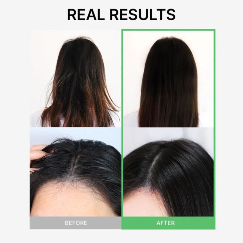 Lador Tea Tree Calming Scalp Treatment (1)
