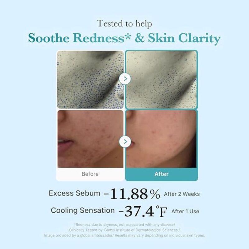 Medicube Azelaic Acid Niacinamide Clear Toner (3)