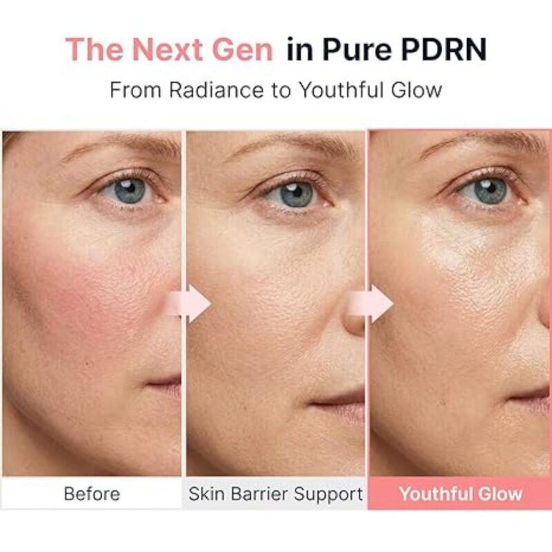 Sungboon Editor PDRN Pink Vitamin Glow Boosting Ampoule (3)