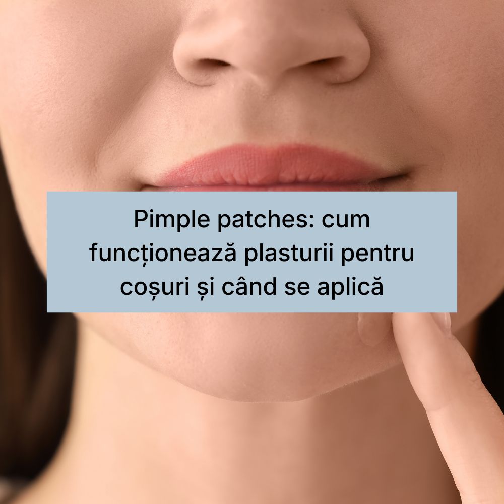 Pimple patches cum funcționează plasturii pentru coșuri și când se aplică