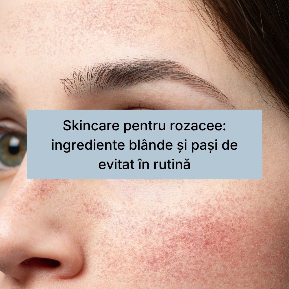 Skincare pentru rozacee ingrediente blânde și pași de evitat în rutină