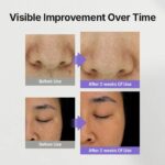 Genabelle Melacare Intensive Cream (6)