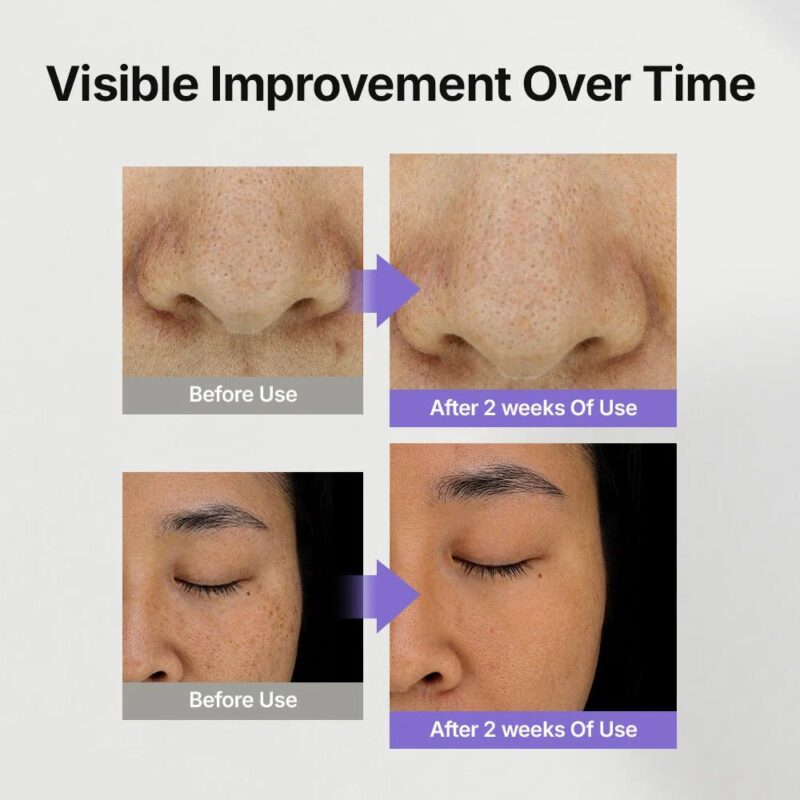 Genabelle Melacare Intensive Cream (6)