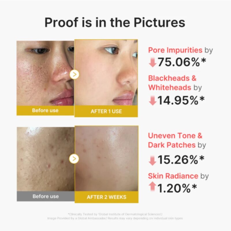 Medicube Kojic Acid Turmeric Peel Shot (2)