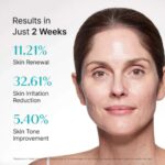 Rejuran Turnover Ampoule (4)