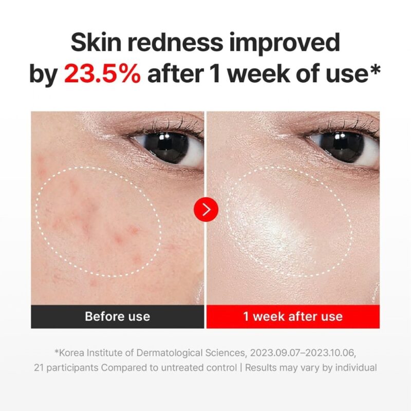 Centellian24 Madeca Cream Time Reverse VARIANTA MINI (2)