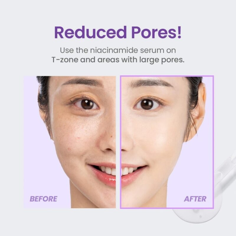 TirTir Niacinamide 20% Serum (4)